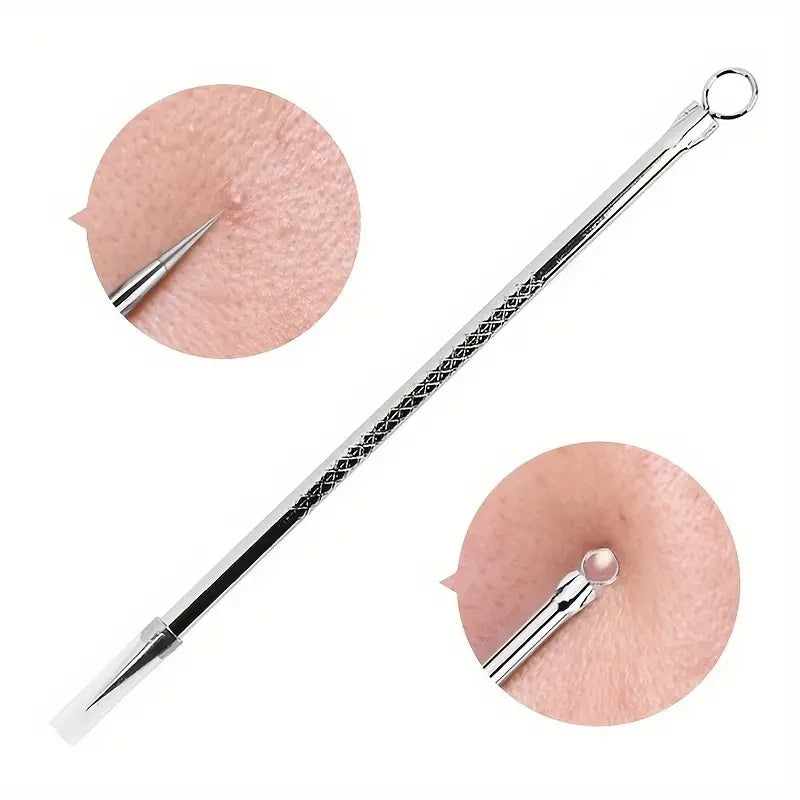 Stainless Steel Blackhead & Acne Extractor Tool – Comedone Pore Cleaning Removal Needle, 1 Piece